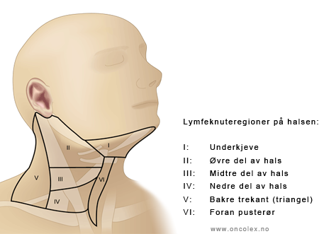 illustrasjon fra Kreftlex: Regioninndeling av hals for fjerning av lymfeknuter.